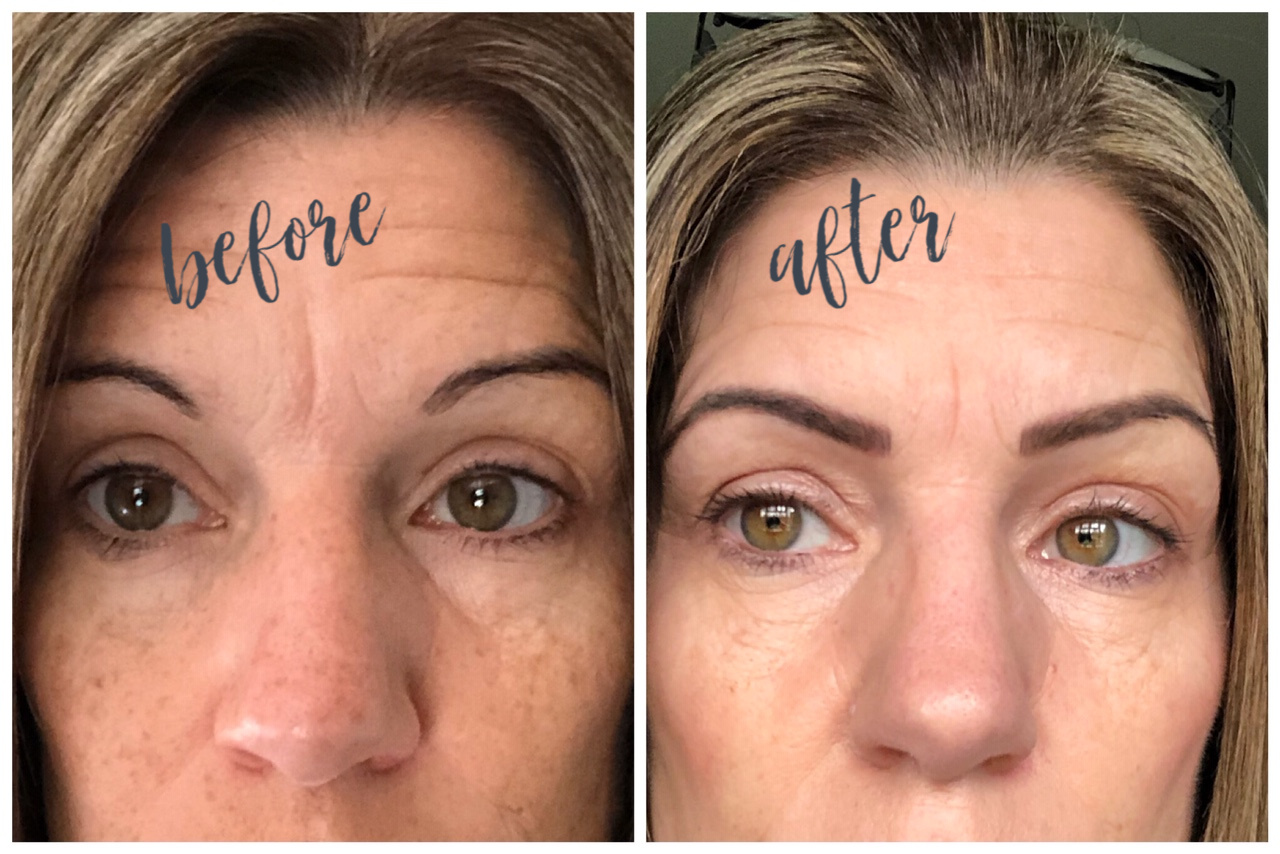 Eyebrow Microblading On Older Skin All You Need To Know Inside